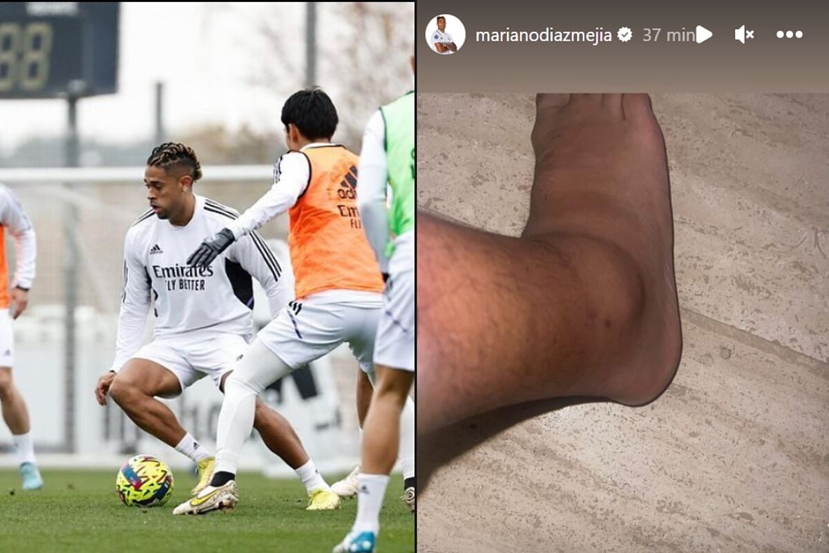 Real Madrid Mariano baja por un esguince de tobillo