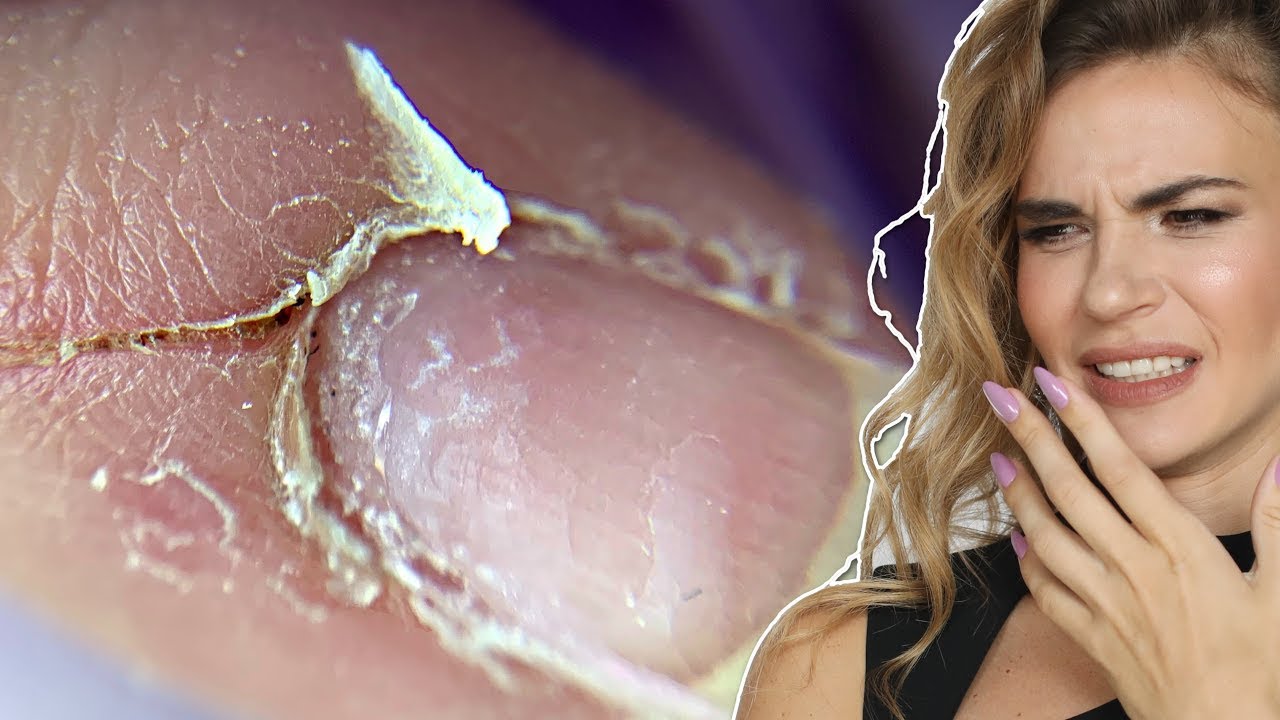 Uñas mordidas y transformación de cutícula cortada | Organic Nails
